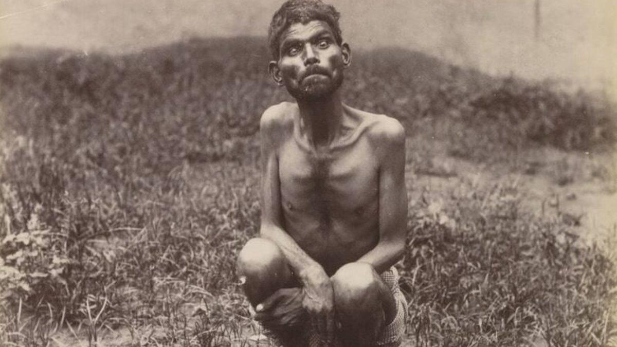 Ormanda Kurtlar Tarafından Büyütülen, Dolunayda Uluyup Kurtlar Gibi Çiğ Et Yiyen Çocukla Tanışın: Dina Sanichar