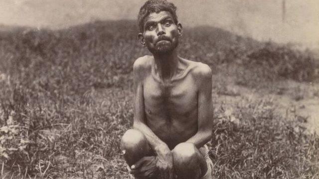 Ormanda Kurtlar Tarafından Büyütülen, Dolunayda Uluyup Kurtlar Gibi Çiğ Et Yiyen Çocukla Tanışın: Dina Sanichar