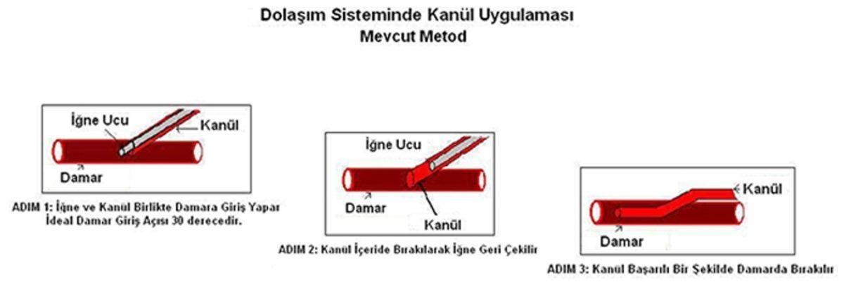 Enkaz Altından Çıkarılan Kişiye Hemen Su Vermek, Sanıldığı Gibi Hayati Risk Taşıyor mu?