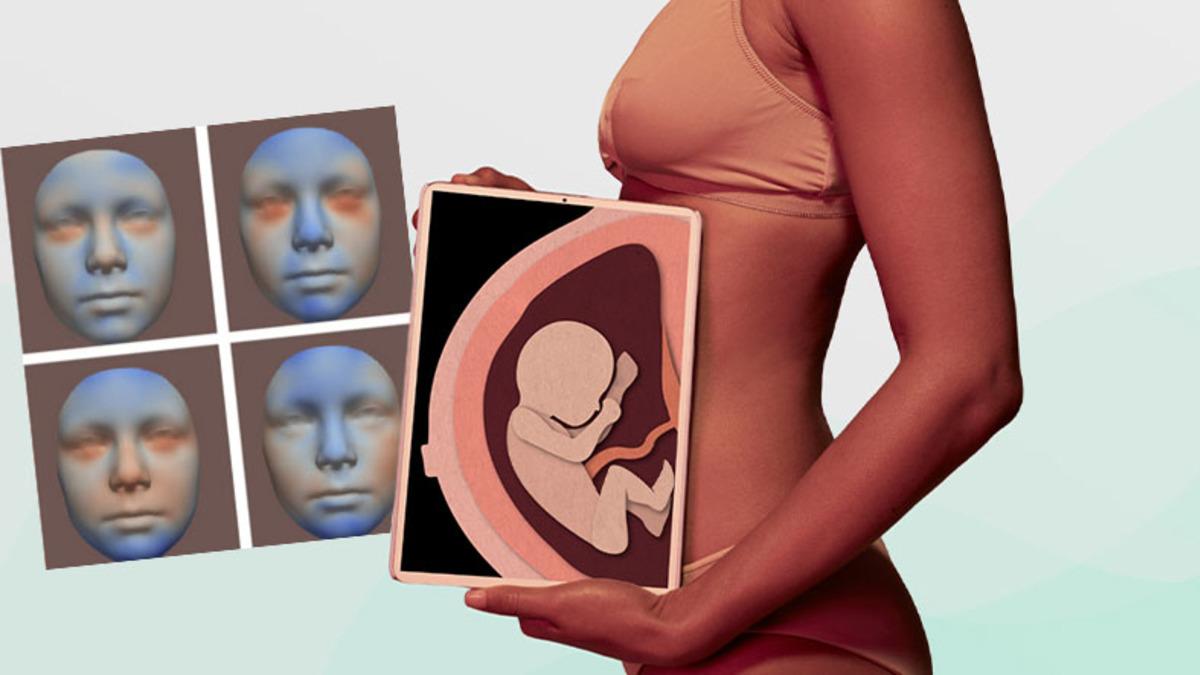 Az Miktarda Tüketilen Alkolün Bile Hamilelik Döneminde Bebeğin Yüz Şeklini Etkilediği Ortaya Çıktı