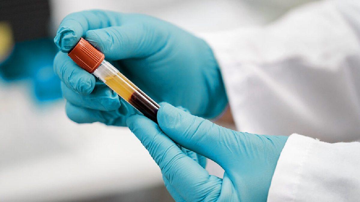 Sadece Kanının Kokusuyla Bile Karşısındakini Felç Edebilen ‘Zehirli Kadın’: Gloria Ramirez