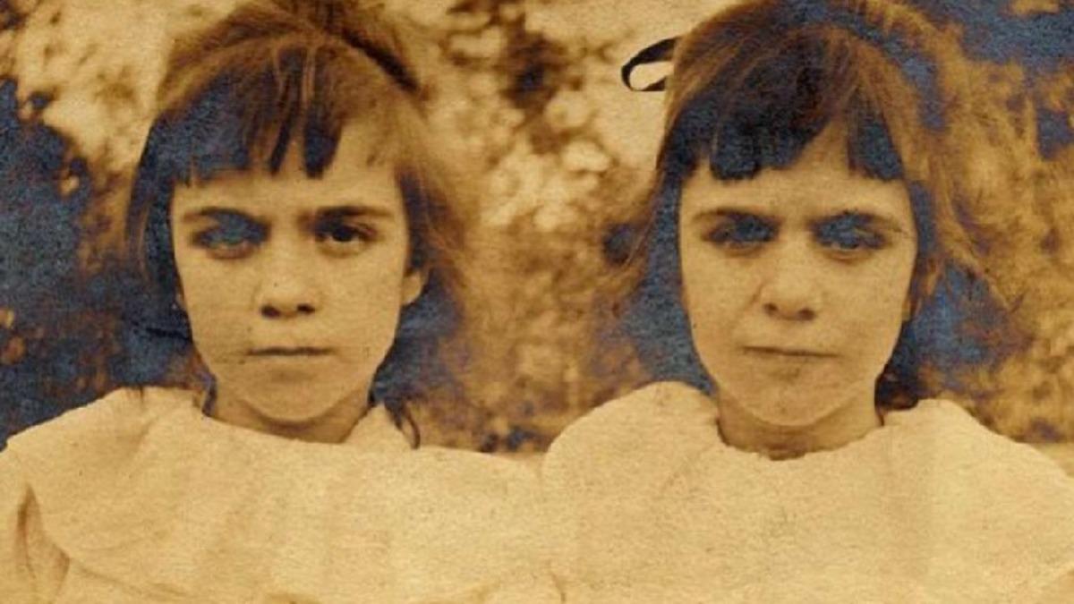 Okuduktan Sonra Reenkarnasyonu Sorgulamamanın İmkansız Olacağı Esrarengiz Olay: Pollock İkizleri