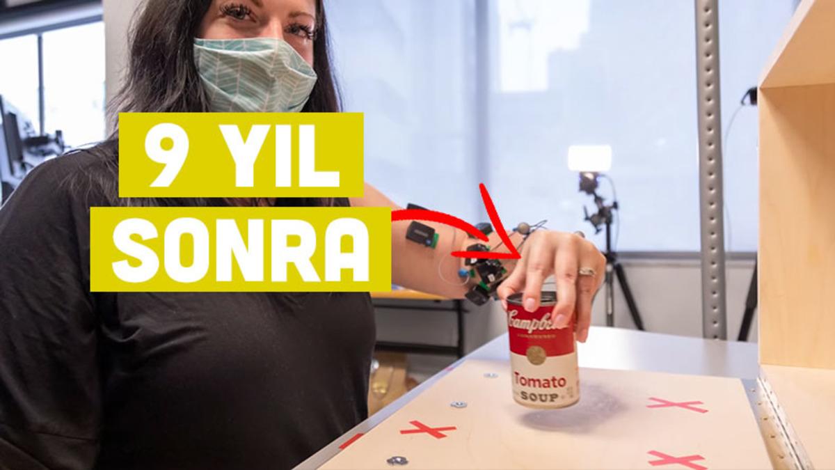 9 Yıldır Felçli Olan Bir Kadın, Yeni Bir Tedavi Yöntemi ile Ellerini Hareket Ettirebildi