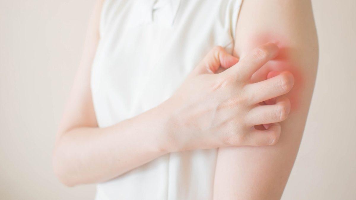 Yaşam Kalitesinin En Büyük Düşmanı Olan ‘Vücutta Kaşıntı’ Neden Olur, Nasıl Geçer?