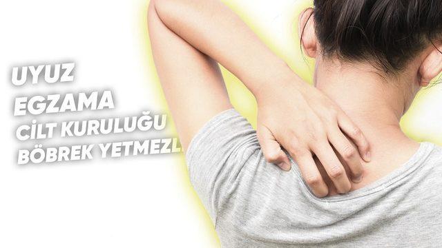 Yaşam Kalitesinin En Büyük Düşmanı Olan ‘Vücutta Kaşıntı’ Neden Olur, Nasıl Geçer?