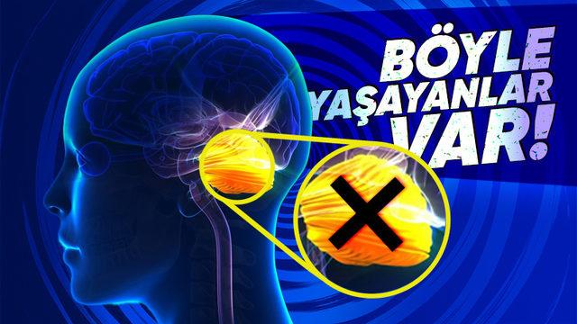 Elinizdeki Telefonu Bile Onun Sayesinde Tuttuğunuz ’Beyincik’ Olmadan Yaşamak Mümkün mü?