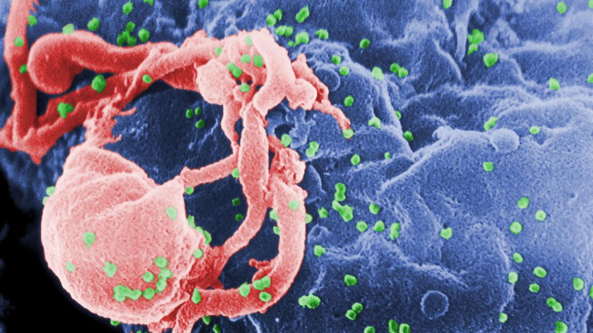 Tarihe Geçen Olay: HIV Pozitif Tanısı Konan Bir Kadın, Tedavi Bile Olmadan İyileşti