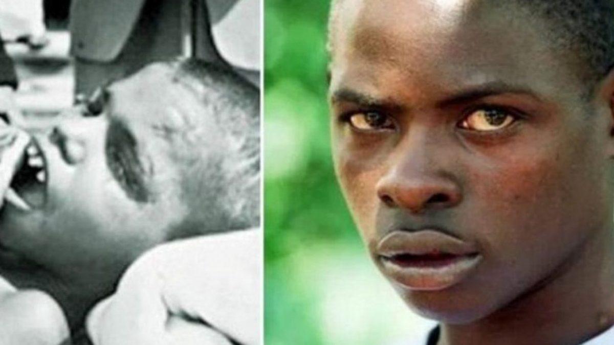 Ormanda Maymunlar Tarafından Büyütüldükten Sonra Olimpiyatlara Katılan Çocuk John Ssabunnya