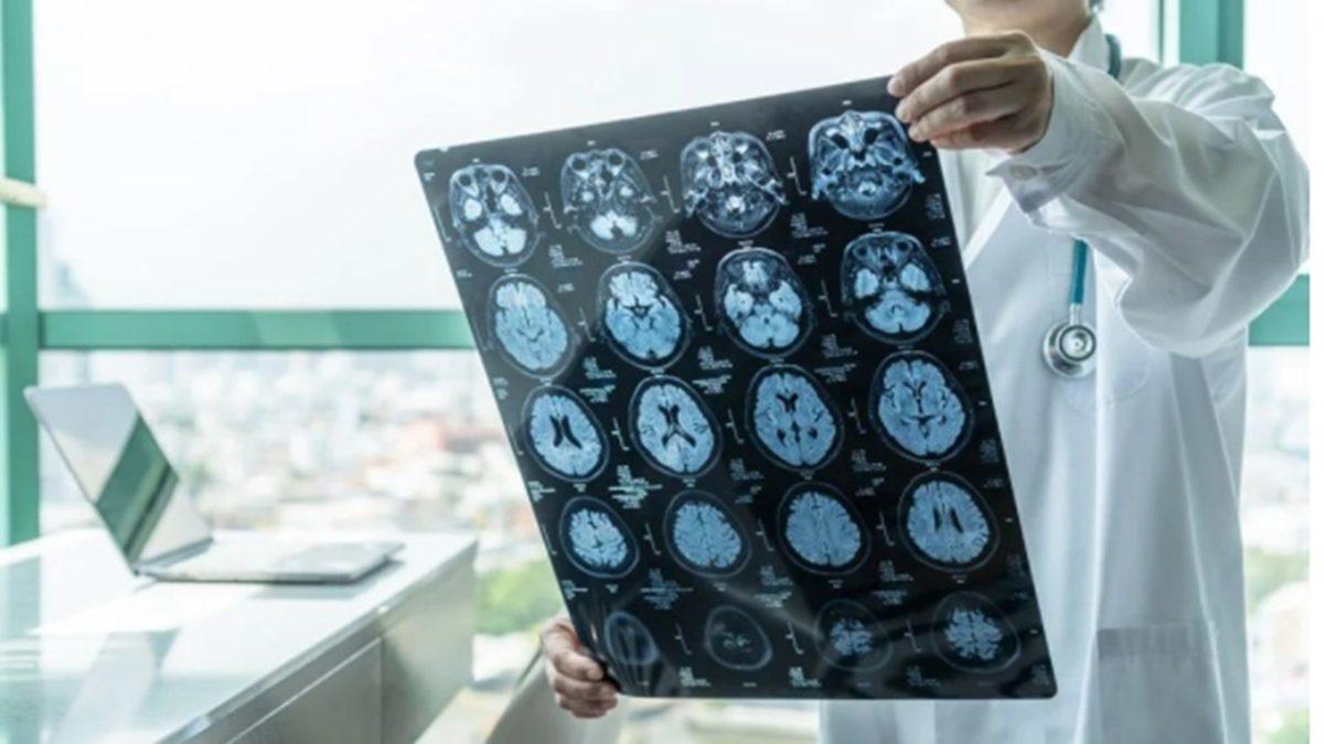 Bu İstatistiği Asla ’Unutmayın’: Aramızda Sinsice Gezen Bu Ölümcül Hastalık Dünyada En Sık Türkiye’de Görülüyor