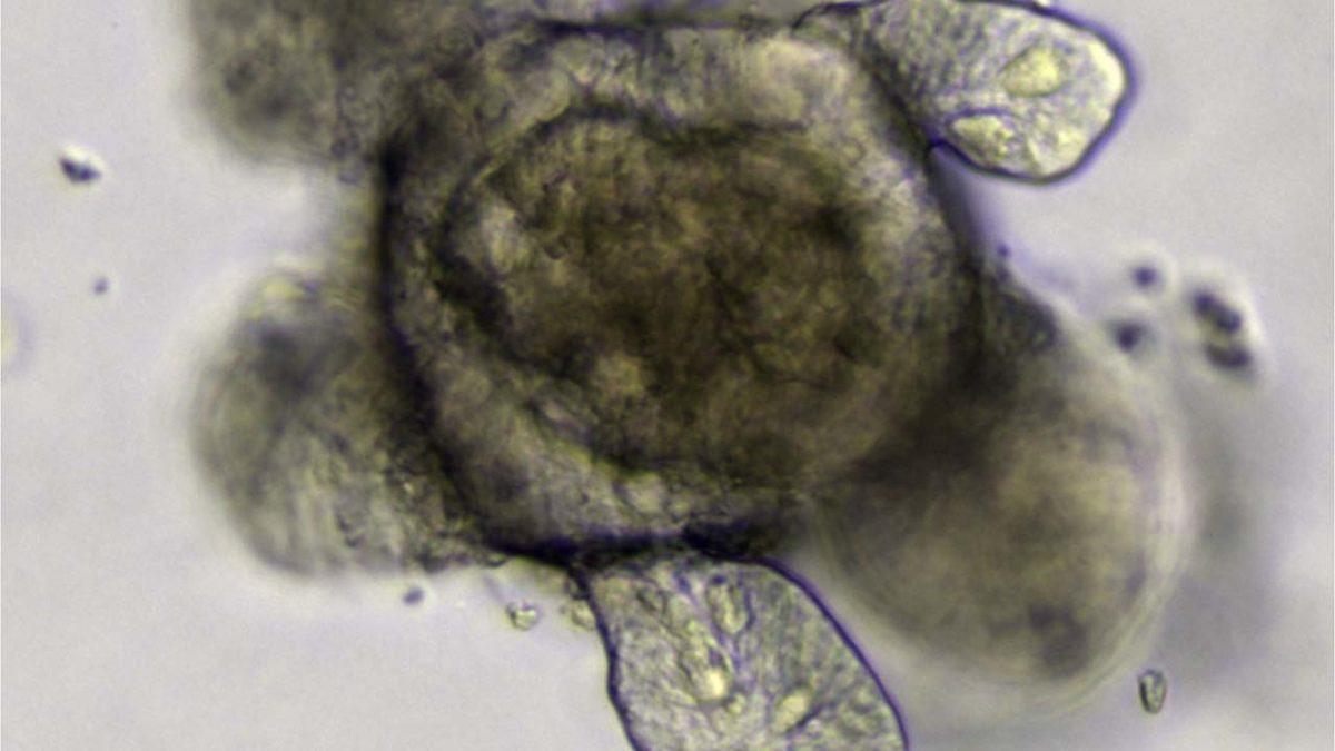 Ultron Gerçek Oluyor: Laboratuvarda Geliştirilen ’Yapay Beyinle’ Yapay Zeka Geliştirilecek