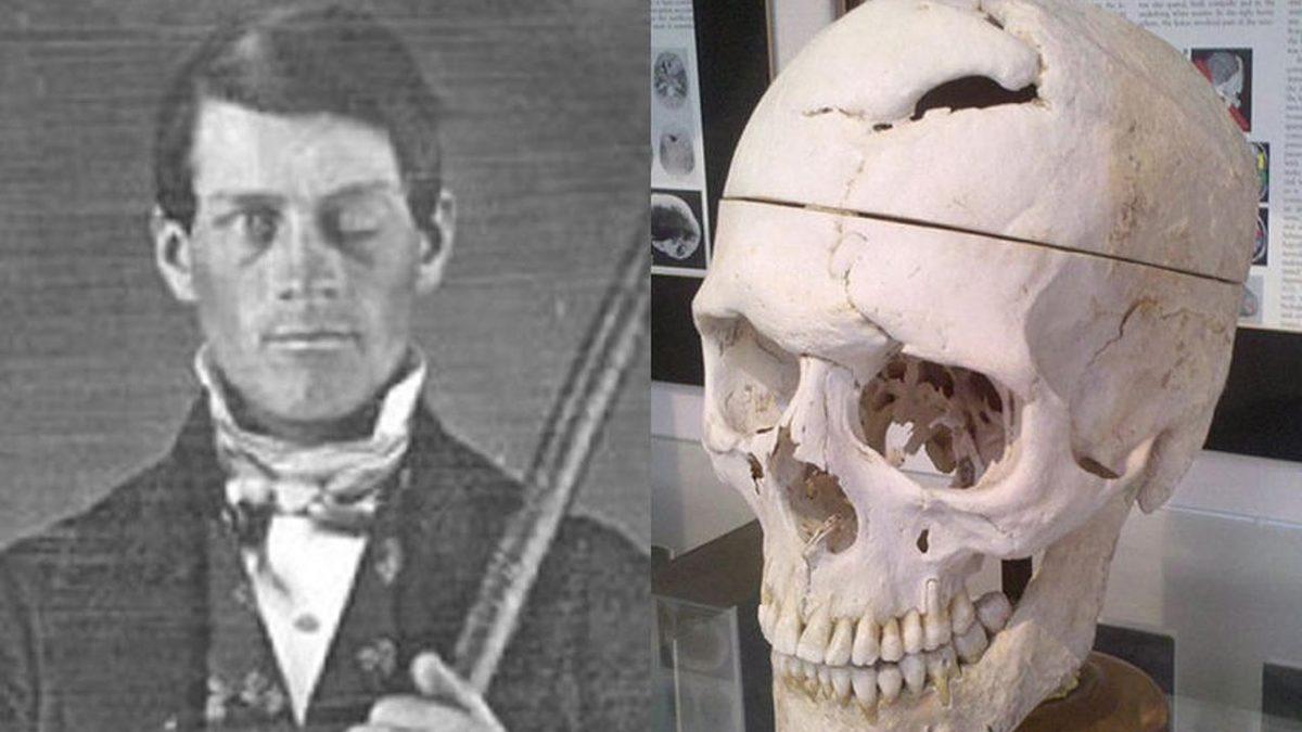 Nasıl Oldu da Bir Beynimizin Olduğu Keşfedildi? İnsan Beyninin Varlığı İlk Ne Zaman, Nasıl ve Kim Tarafından Anlaşıldı?