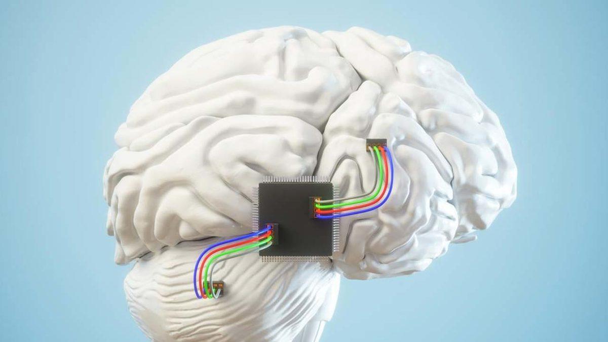 Elon Musk’ın Beyne Çip Yerleştirme Projesinin İnsanlı Testler İçin Onay Alamadığı Ortaya Çıktı