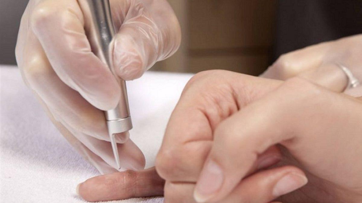 Vücudumuzun Her Noktasında Görülebilen ’Deri Hastalığı’ Siğil Neden Çıkar, Nasıl Tedavi Edilir?