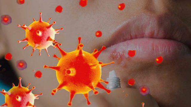 Oramızda Buramızda Çıkan Uçukların Sinir Sistemimizi Nasıl İstila Ettiği Keşfedildi