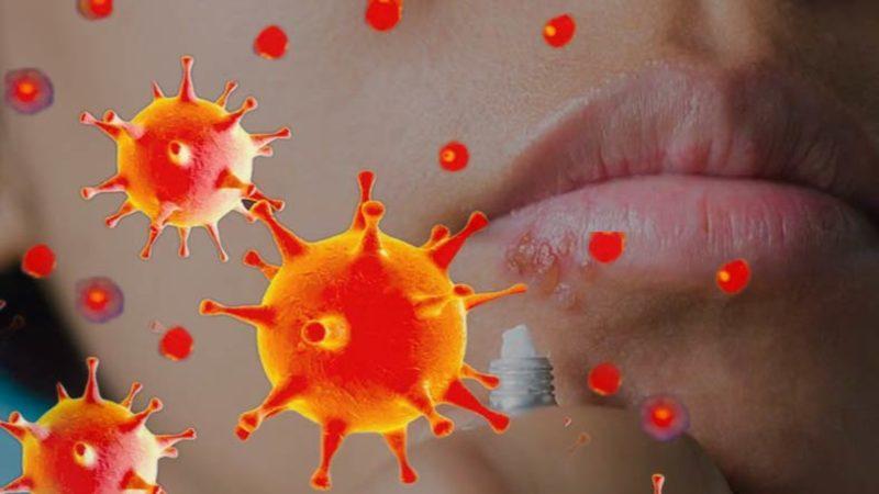 Oramızda Buramızda Çıkan Uçukların Sinir Sistemimizi Nasıl İstila Ettiği Keşfedildi