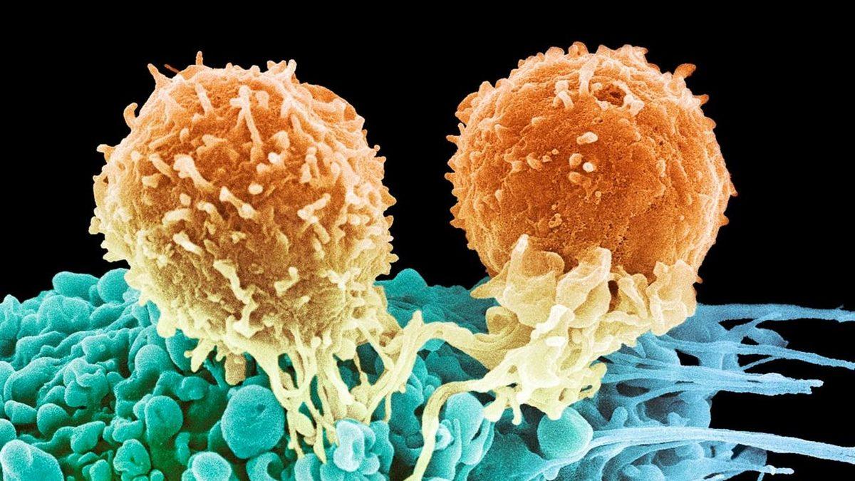 Kanserin 30 Yıl İçinde Dünya Ekonomisinde Yaratacağı Dudak Uçuklatan Etki Hesaplandı