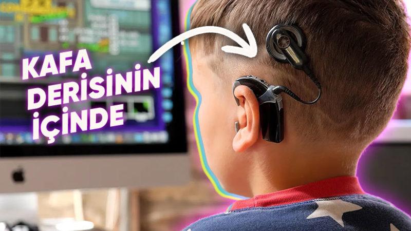 Ölü Hücreleri Bile Telafi Edebilen Bu İşitme Cihazının Çalışma Prensibini Öğrenince Teknolojiye Olan Saygınız Artacak!