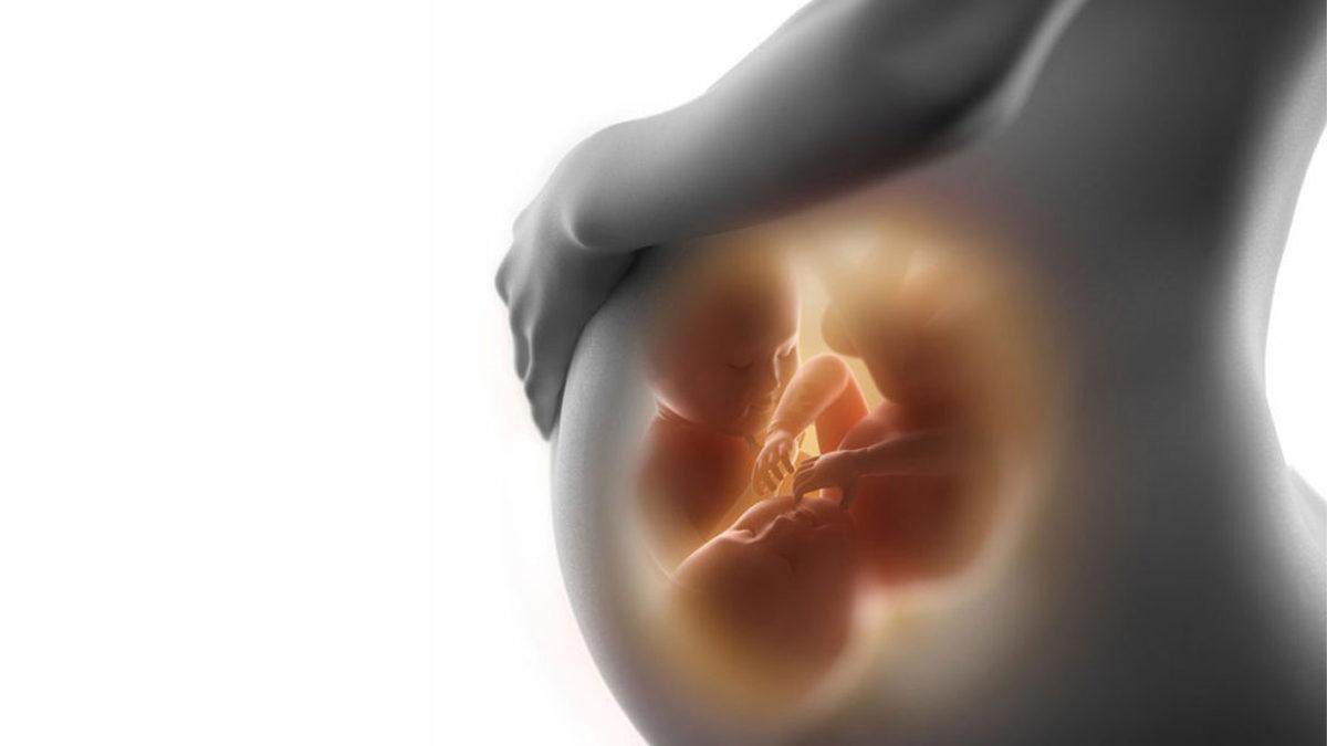 1 Yaşındaki Bebeğin Beyninden, Kendi İkiz Kardeşi Çıkarıldı