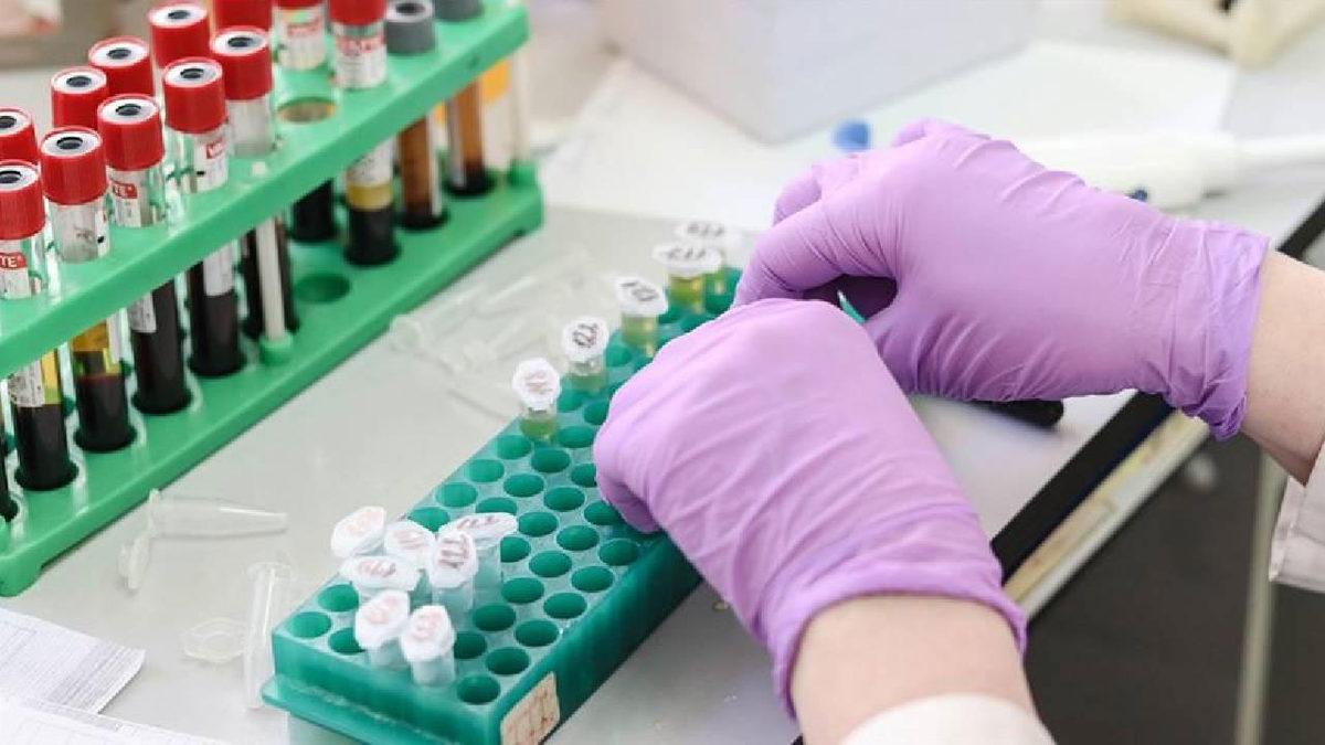 Yerli Koronavirüs Aşısı TURKOVAC İçin Acil Kullanım Onayı Başvurusu Yapıldı