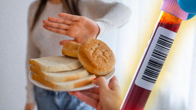 Çölyak Hastalığının Tanısında Kullanılan ’Anti Gliadin IgA ve IgG Testi’ Nedir, Referans Aralığı Kaç Olmalı?