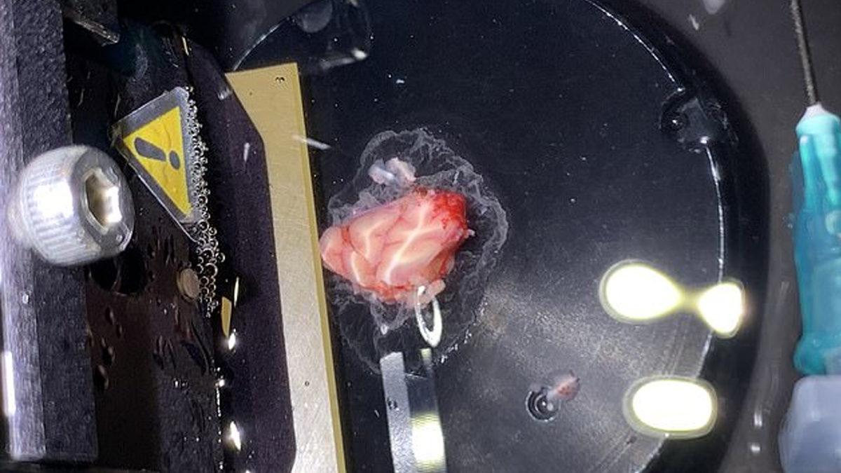 Tarihte Bir İlk: İnsan Beyninden Alınan Bir Parça, 12 Saat Boyunca Dışarıda Canlı Tutuldu