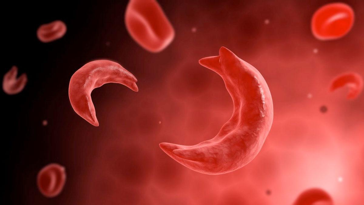 Apple Watch’ların ’Ağrı Tahmini’ Yapabildiği Keşfedildi: İşte ’Orak Hücreli Anemi’ Hastaları Üzerine Yapılan Araştırma Sonuçları