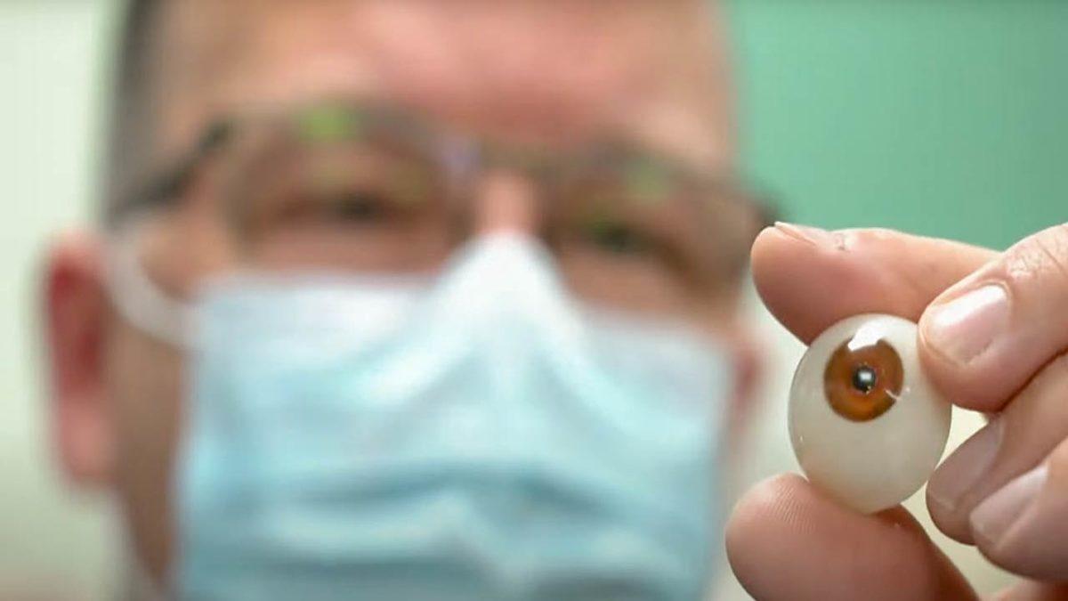 Dünyada Bir İlk: Üç Boyutlu Yazıcı ile Üretilen Protez Göz Bir Hastaya Nakledildi