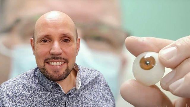 Dünyada Bir İlk: Üç Boyutlu Yazıcı ile Üretilen Protez Göz Bir Hastaya Nakledildi