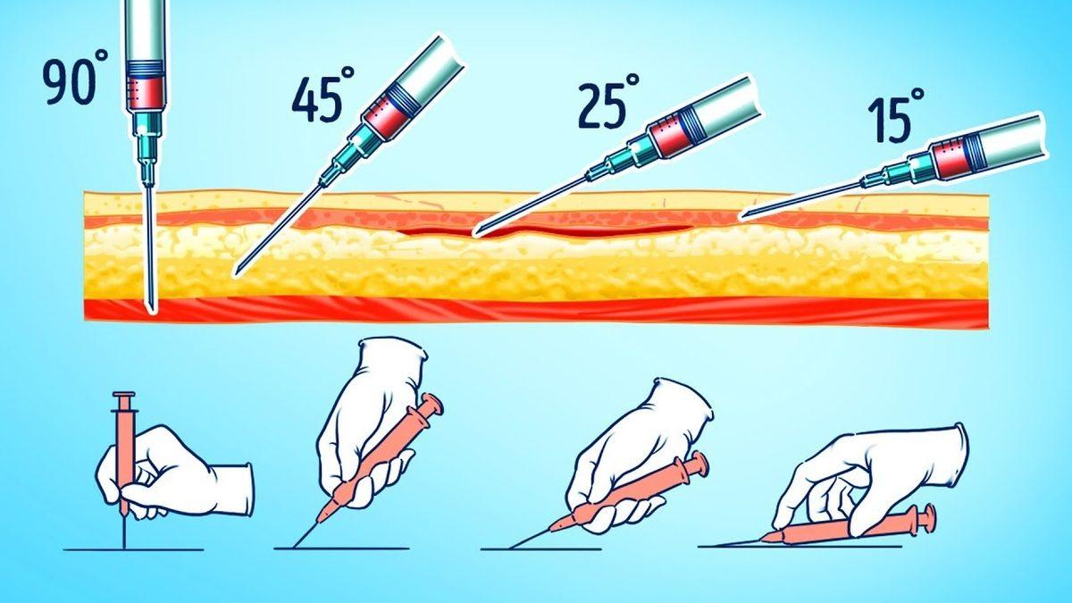 Bazıları Koldan Yapılabilirken Neden İğne (Enjeksiyon) Özellikle Kalçadan Yapılır?