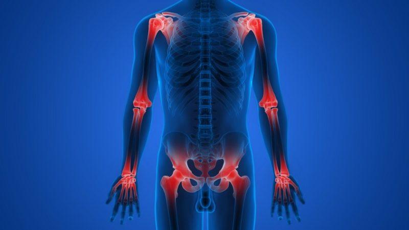 Vücudumuzdaki Eklemlerin Rahat Bir Şekilde Hareket Etmesini Sağlayan Glukozamin Nedir, Ne İşe Yarar?