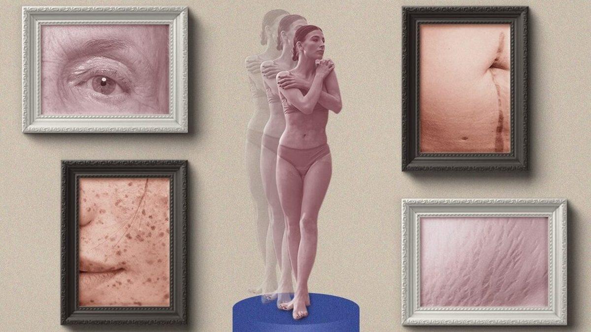 Aynaya Bakınca Kendisini Canavar Gibi Gören İnsanların Yaşadığı Ürkütücü Psikolojik Rahatsızlık