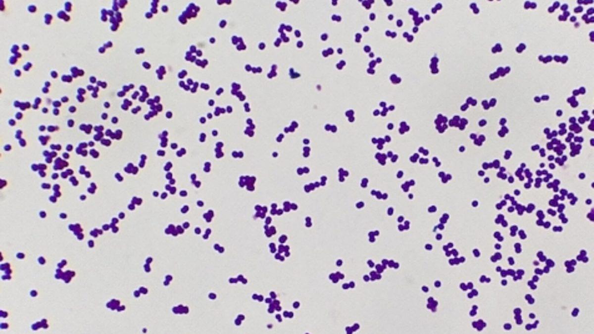 Kanser Tedavilerinde Devrim Yaratabilecek Araştırma: İnsan Vücudunda da Bulunan Bir Bakteri Yoluyla Tümör Yok Edildi!