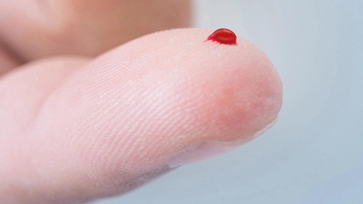 Alzheimer Riskini Yıllar Öncesinden Basit Bir Kan Testiyle Gösterebilecek Bir Model Üzerinde Çalışılıyor