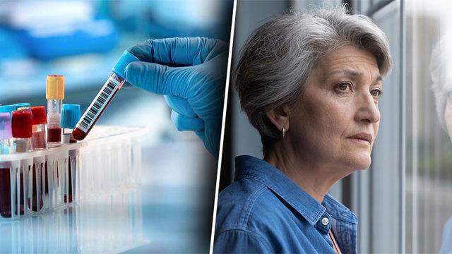 Alzheimer Riskini Yıllar Öncesinden Basit Bir Kan Testiyle Gösterebilecek Bir Model Üzerinde Çalışılıyor