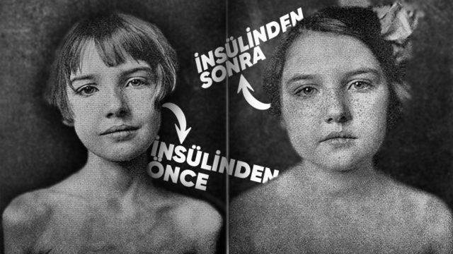 İnsülinin Patentini "Sadece 1 Dolara" Satarak Sayısız Hayatı Kurtaran Bilim İnsanlarıyla Tanışın!