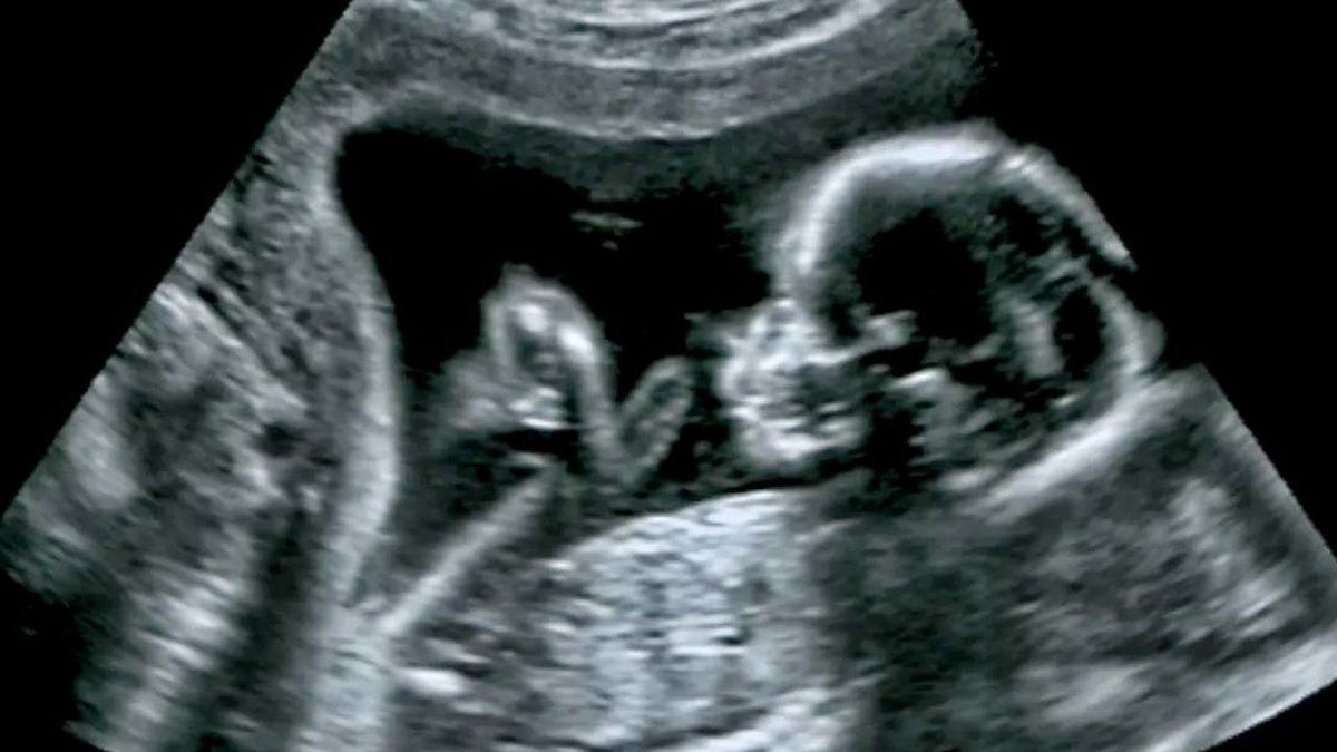 Tıp Tarihinde Bir İlk: Anne Karnındaki Bebeğe Beyin Ameliyatı Yapıldı!