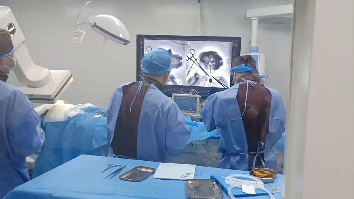 Tarihte İlk Kez Bir Primat Beyni ’Güvenli Bir Şekilde’ Bilgisayara Bağlandı