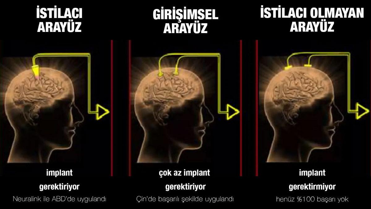 Tarihte İlk Kez Bir Primat Beyni ’Güvenli Bir Şekilde’ Bilgisayara Bağlandı