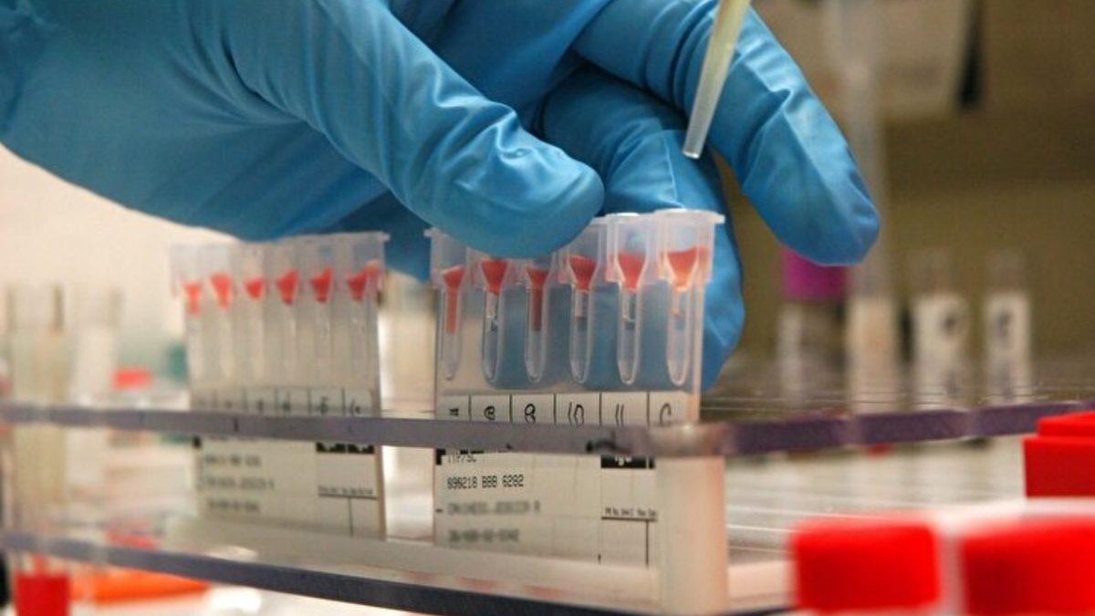 Tuhaf Bir Şekilde Dünyada Yalnızca İki Ailede Bulunan Kan Grubu: Sara