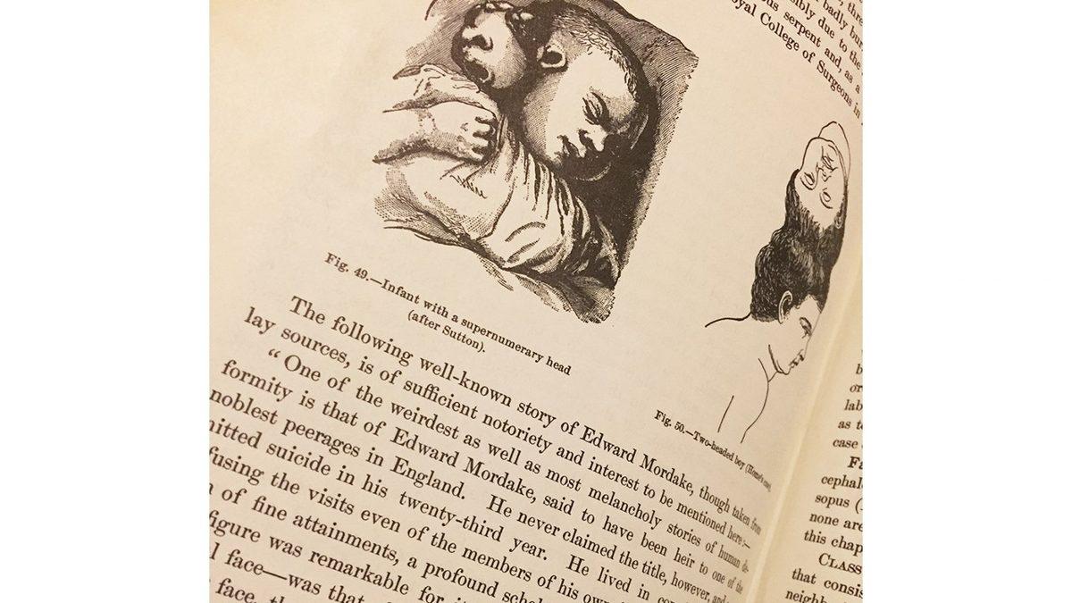 Kafasının Arkasında Ona Fısıldayan Şeytani Bir Yüzle Doğduğu İddia Edilen Gizemli Adam: Edward Mordrake