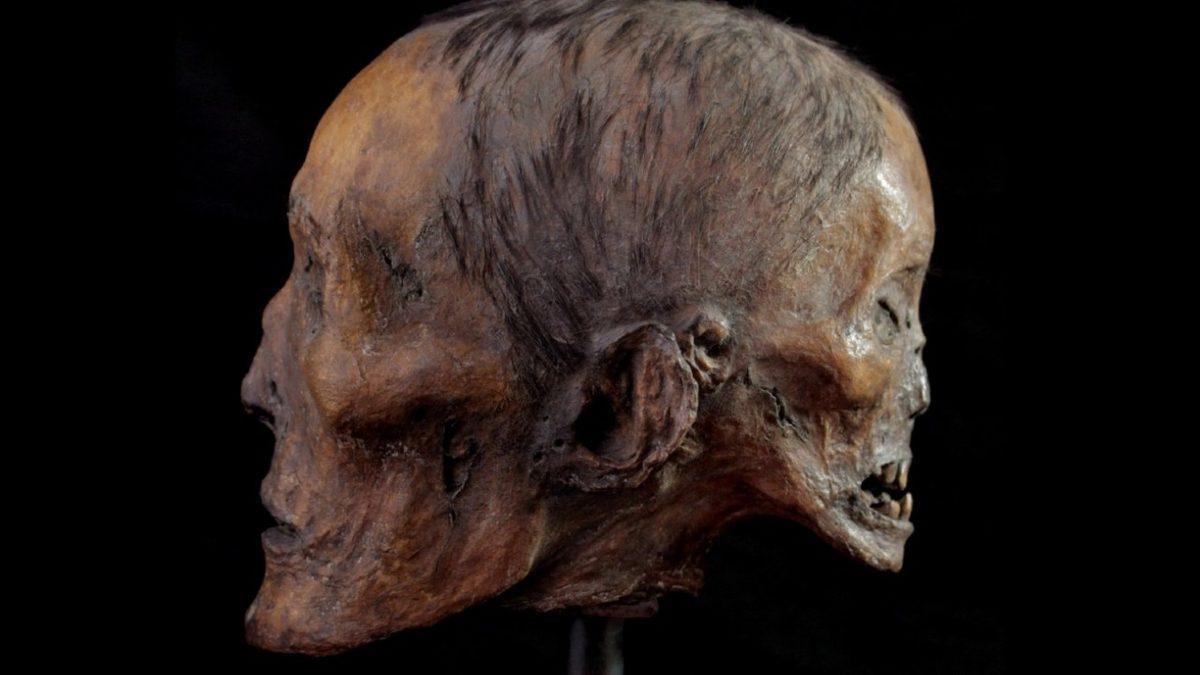 Kafasının Arkasında Ona Fısıldayan Şeytani Bir Yüzle Doğduğu İddia Edilen Gizemli Adam: Edward Mordrake