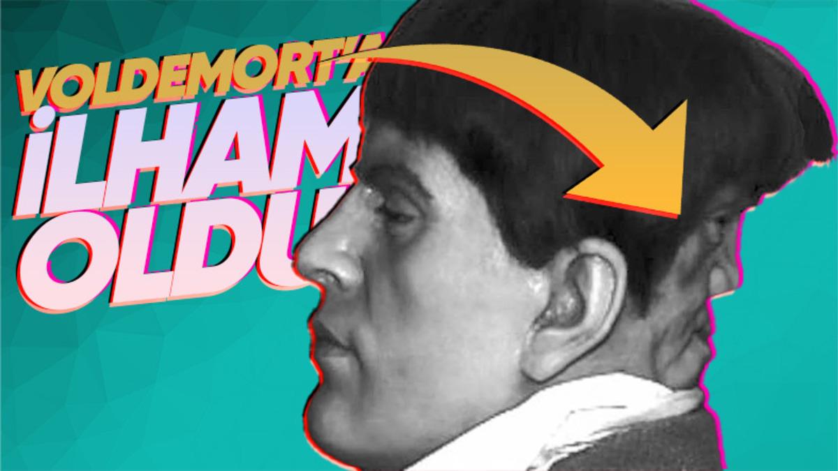 Kafasının Arkasında Ona Fısıldayan Şeytani Bir Yüzle Doğduğu İddia Edilen Gizemli Adam: Edward Mordrake