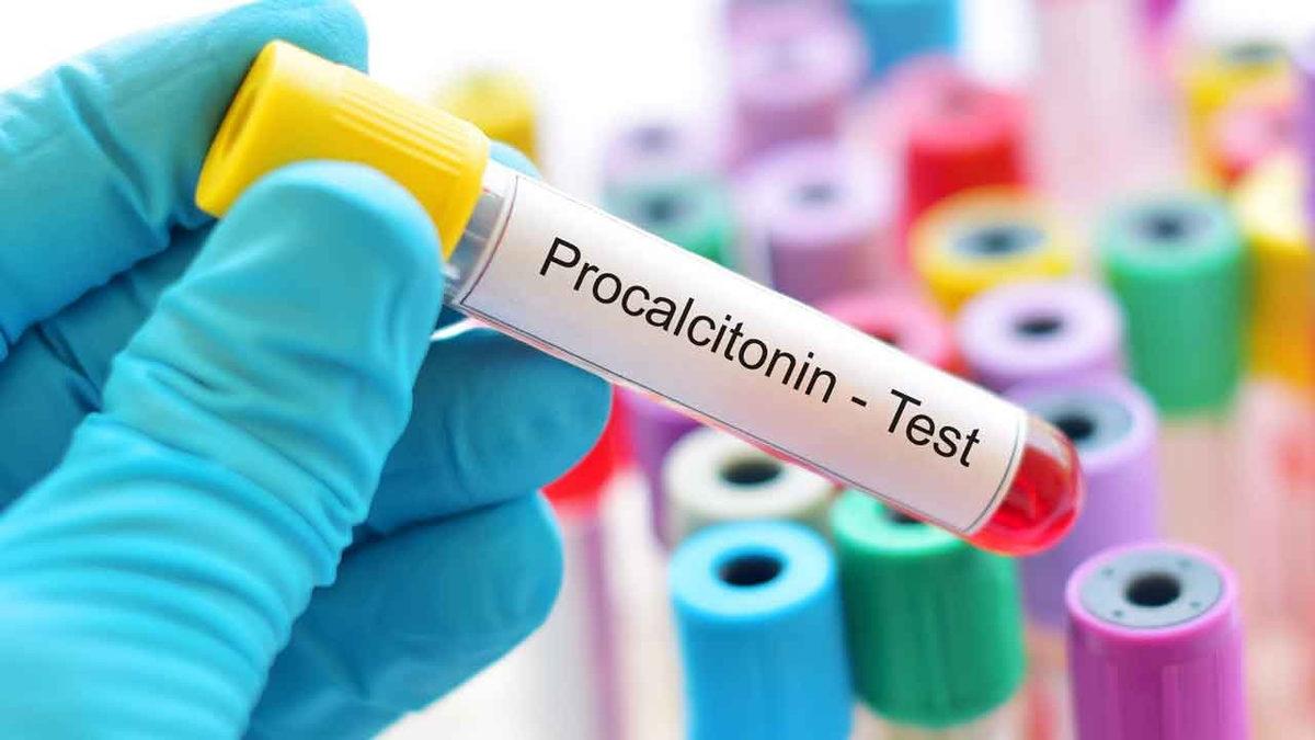 Kan Tahlilinde Karşımıza Çıkan ve Enfeksiyon Yoğunluğunu Gösteren Terim: PCT Nedir, Düşüklüğü ve Yüksekliği Ne Anlama Gelir?