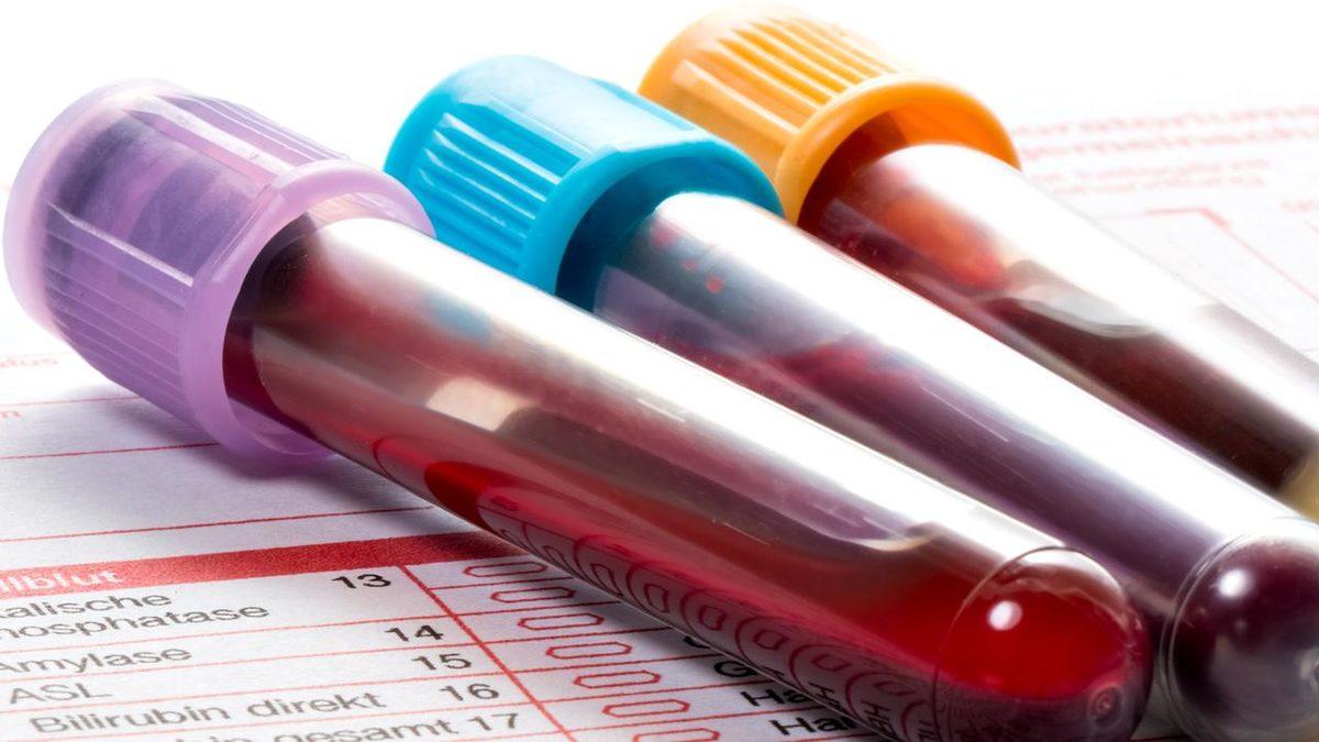 ’Tam Kan Sayımı’ Olarak da Bilinen Hemogram Testi ile Pek Çok Hastalığı Daha Ortaya Çıkmadan Tespit Etmek Mümkün: Hemogram Nedir, Kaç Olmalı?