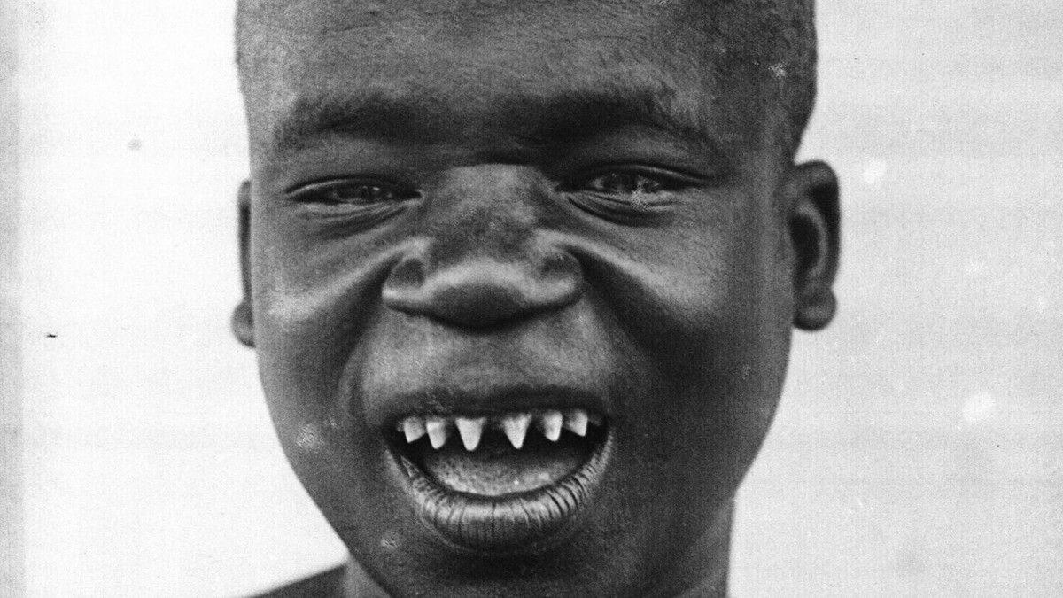 Okuyunca Irkçılığın Nasıl Bir İllet Olduğunu Göreceğiniz Gerçek Bir Hayat Hikâyesi: Ota Benga