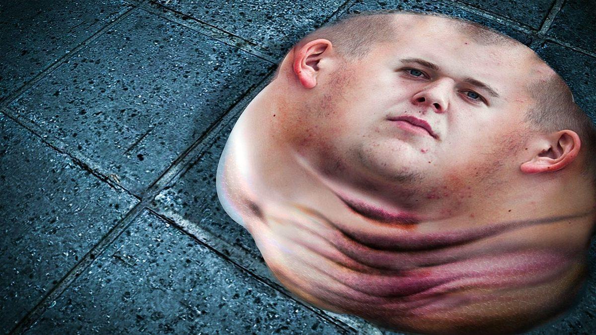 Vücudumuzdaki Tüm Kemikler Birden Yok Olsaydı Hayatta Kalabilir miydik?