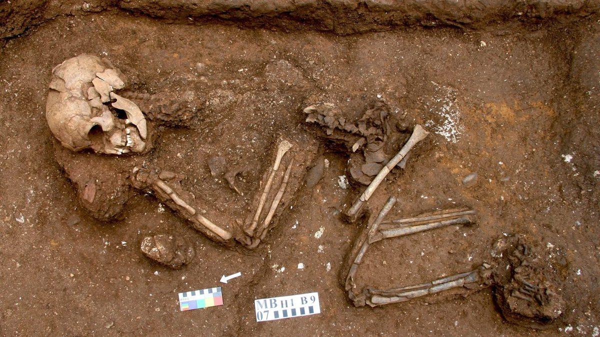 Vücudumuzdaki Tüm Kemikler Birden Yok Olsaydı Hayatta Kalabilir miydik?