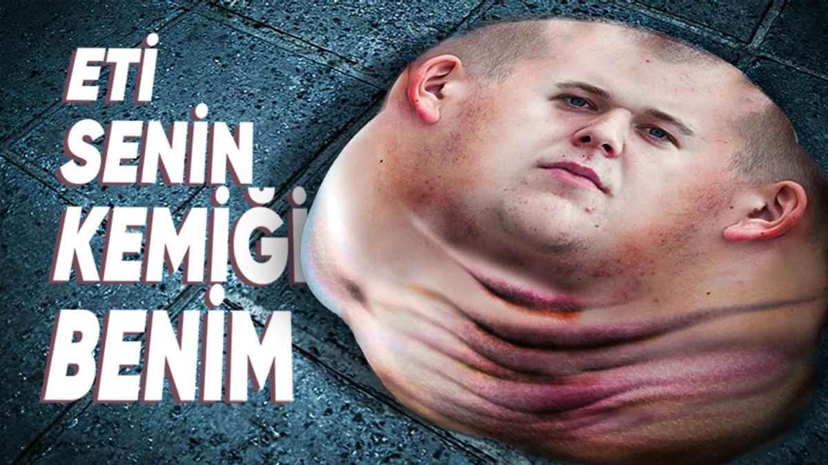 Vücudumuzdaki Tüm Kemikler Birden Yok Olsaydı Hayatta Kalabilir miydik?