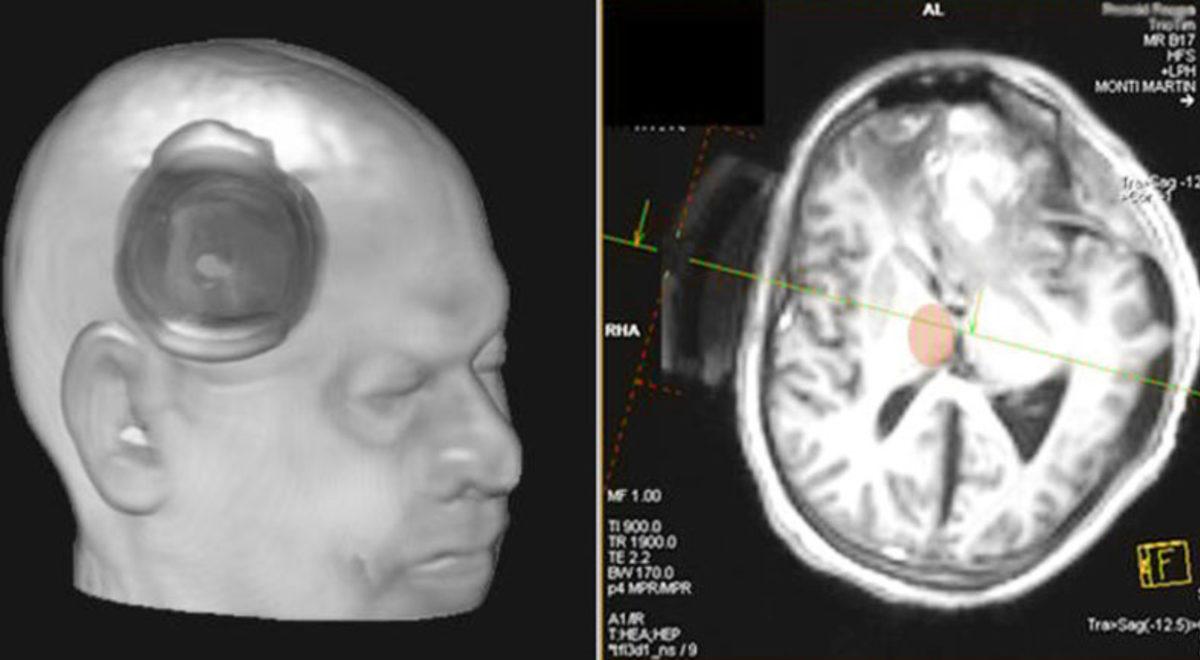 Olur da Bir Gün Komaya Girip En Az 10 Yıl Sonra Uyanırsanız Bu 4 Psikolojik Sorunu Yaşardınız!