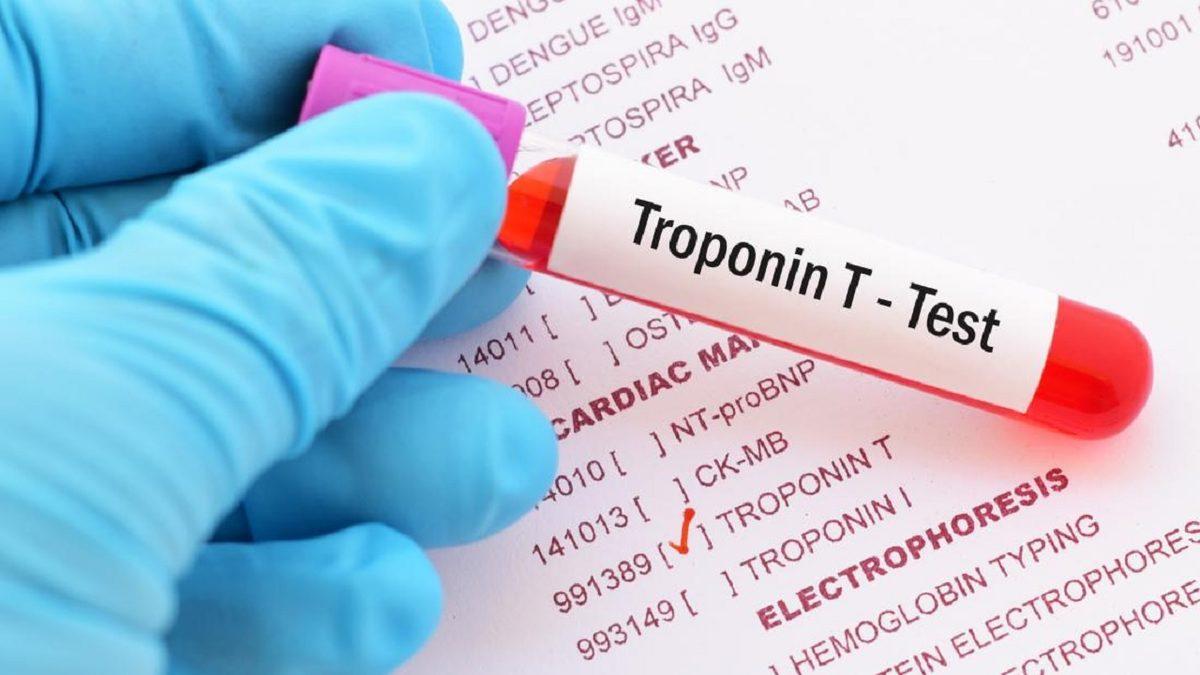 Ölçümü Sayesinde Kalp ile İlgili Sorunları Öğrenmemizi Sağlayan ’Troponin’ Nedir, Yüksekliği Ne Anlama Gelir?